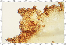 Balsamia polysperma
